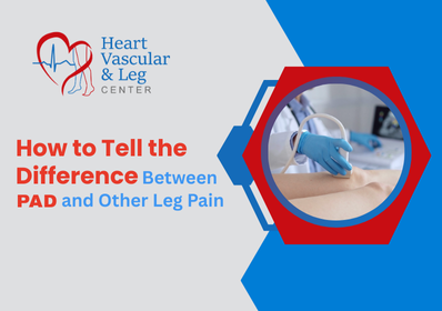 How to Tell the Difference Between PAD and Other Leg Pain