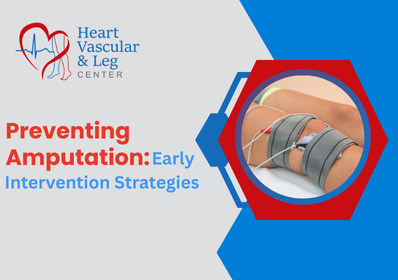 Preventing Amputation