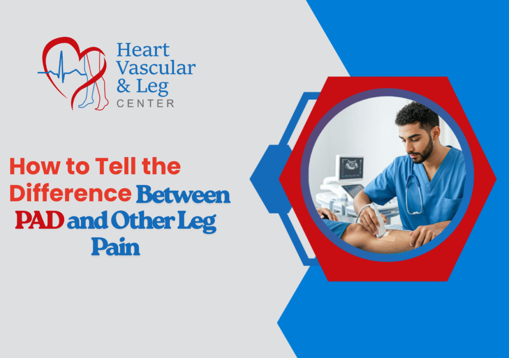 How to Tell the Difference Between PAD and Other Leg Pain