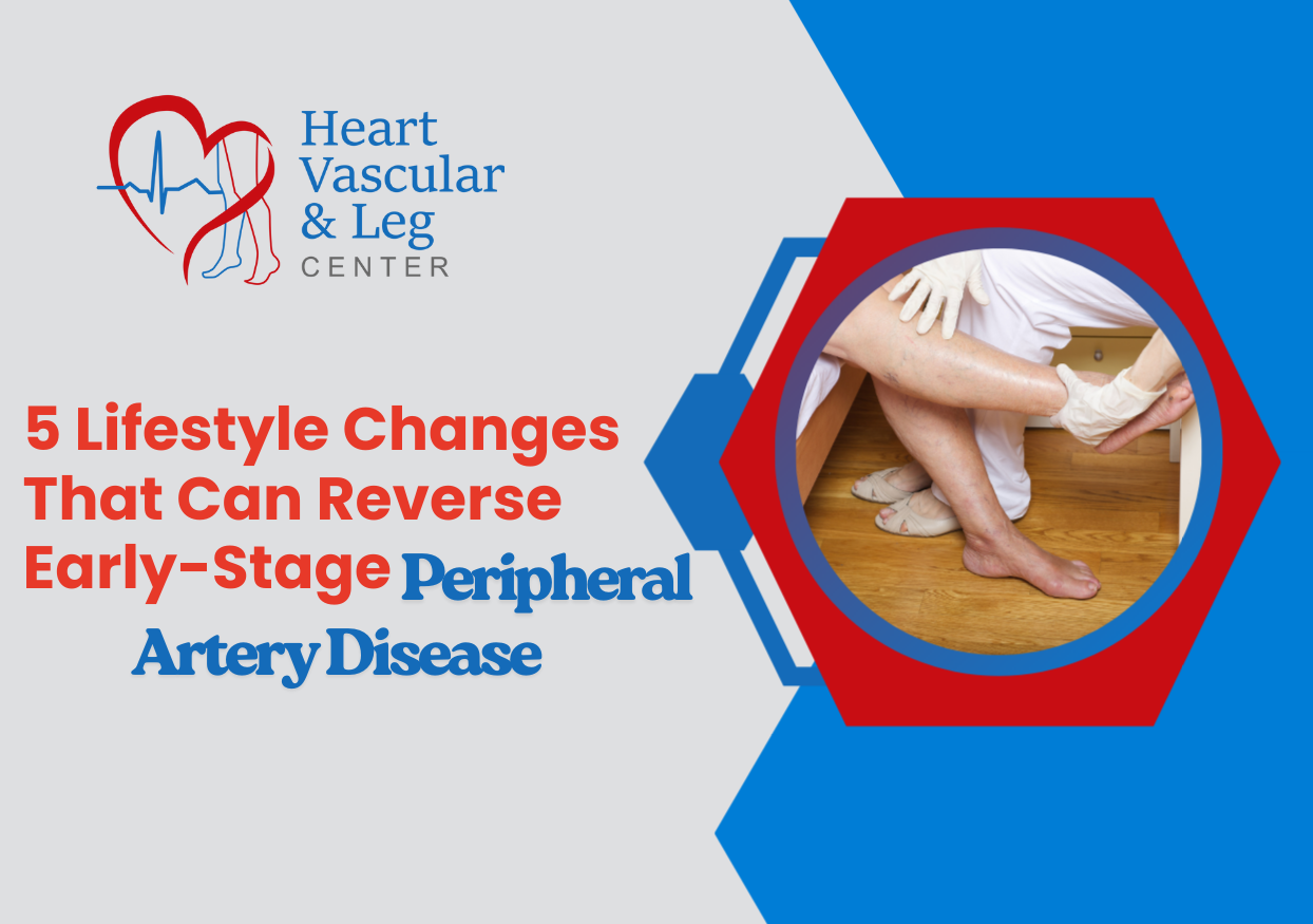5 Lifestyle Changes That Can Reverse Early-Stage Peripheral Artery Disease
