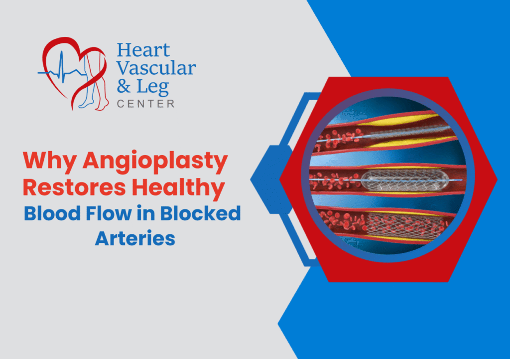 Why Angioplasty Restores Healthy Blood Flow in Blocked Arteries