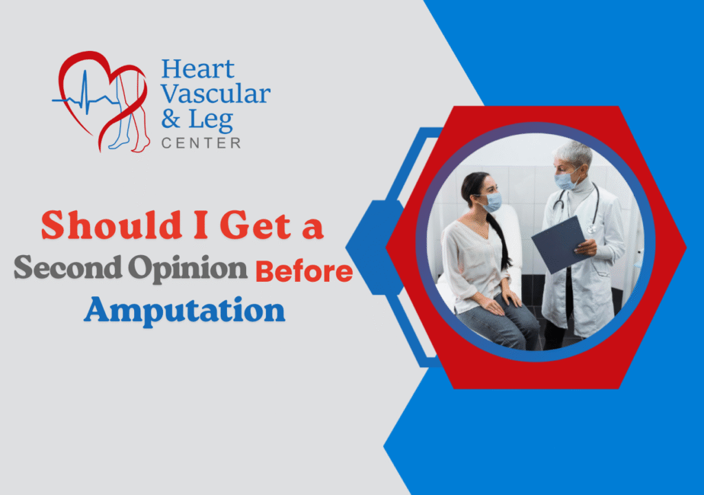 Should I Get a Second Opinion Before Amputation