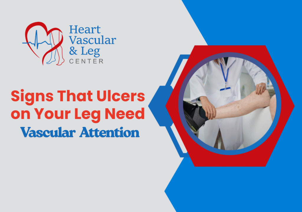 Signs That Ulcers on Your Leg Need Vascular Attention