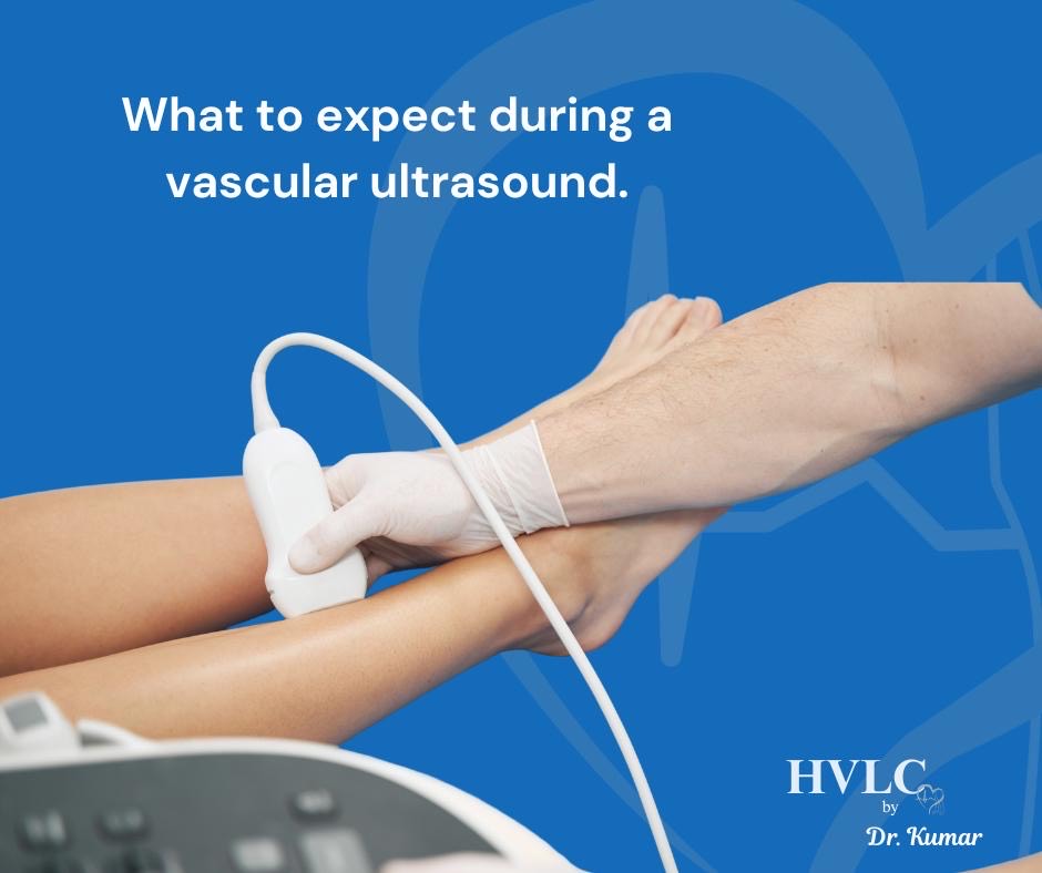 What to Expect During a Vascular Ultrasound