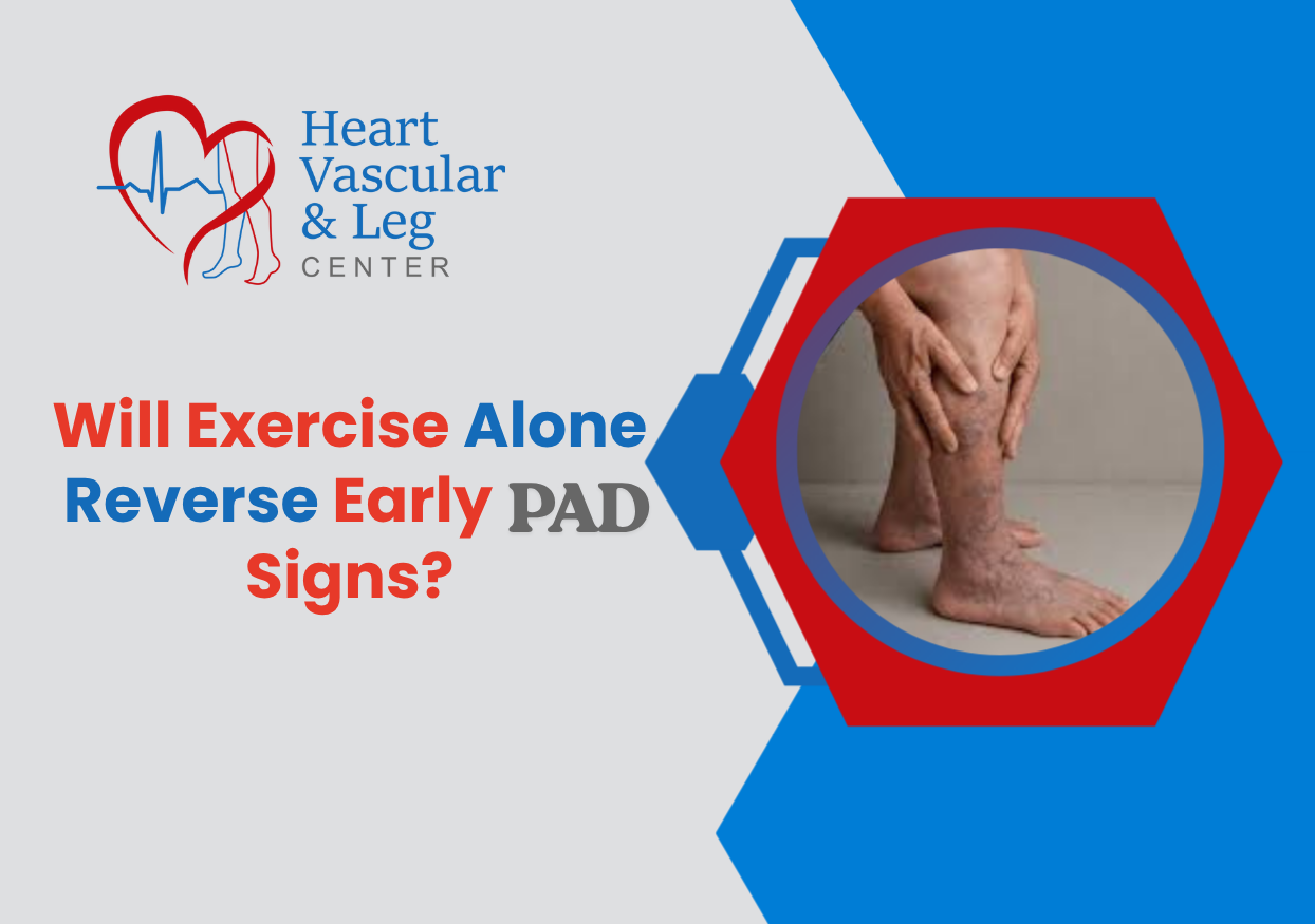 Will Exercise Alone Reverse Early PAD Signs?