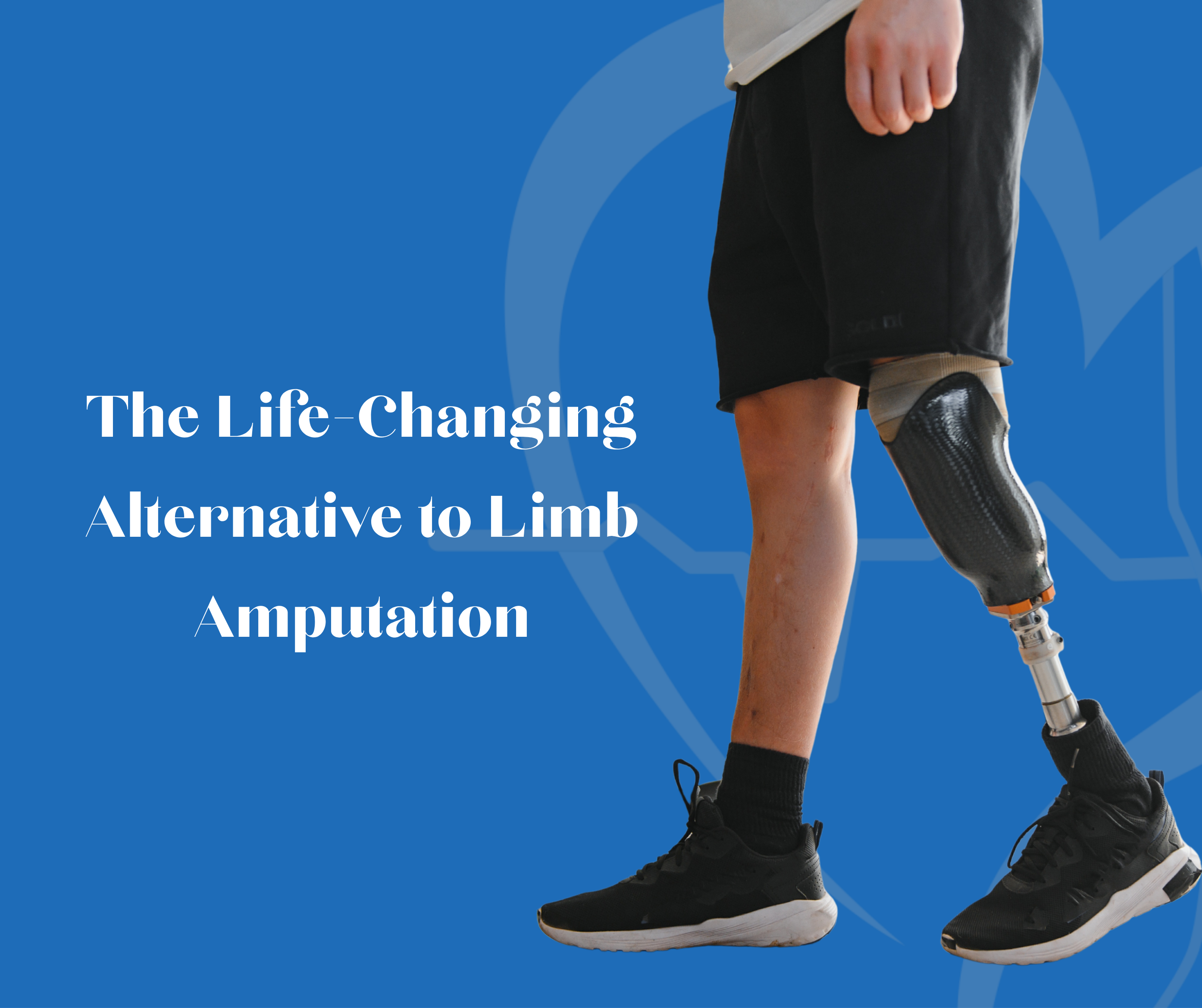 The Life-Changing Alternative to Limb Amputation