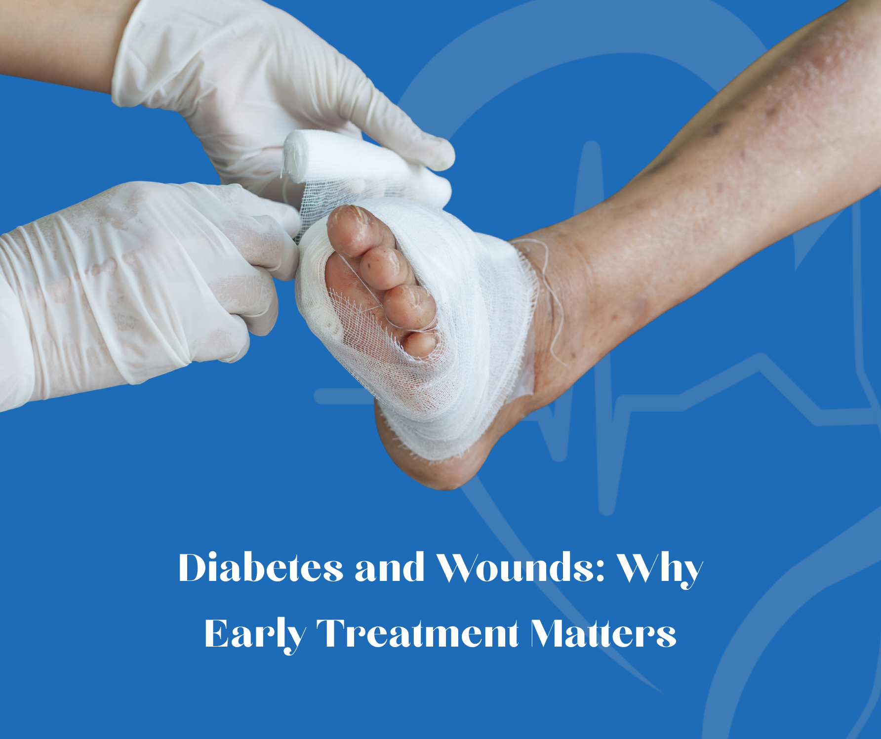 Diabetes and Wounds: Why Early Treatment Matters