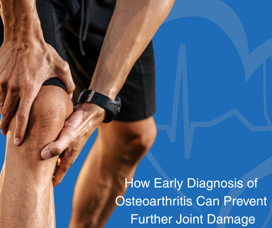 How Early Diagnosis of Osteoarthritis Can Prevent Further Joint Damage