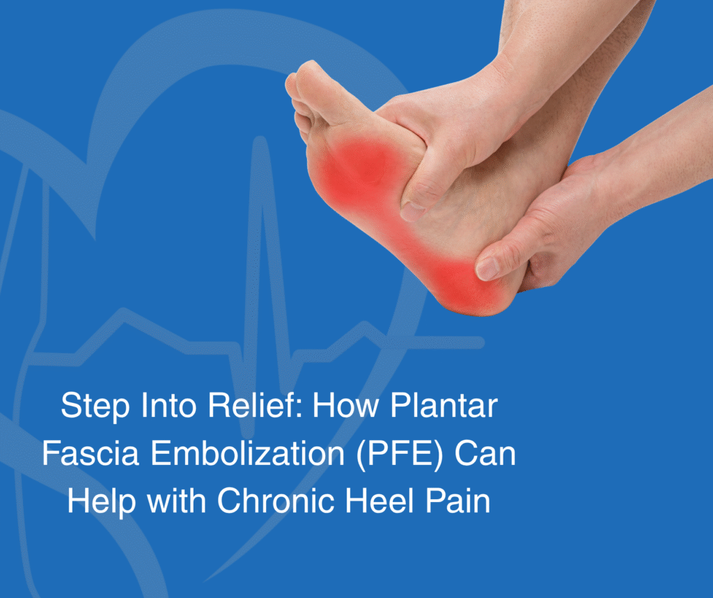 Step Into Relief: How Plantar Fascia Embolization (PFE) Can Help with Chronic Heel Pain