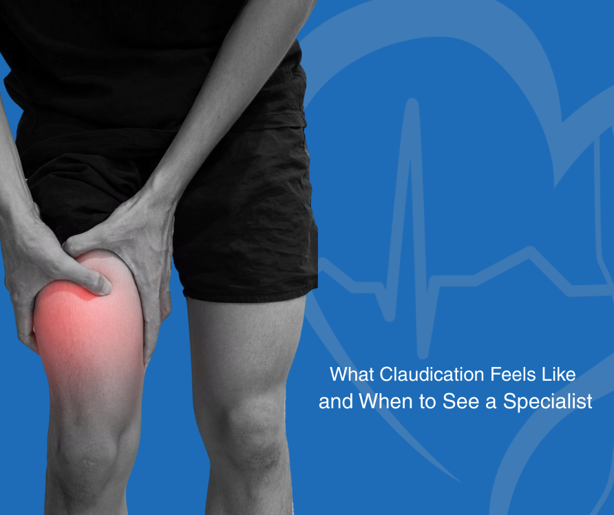 What Claudication Feels Like and When to See a Specialist