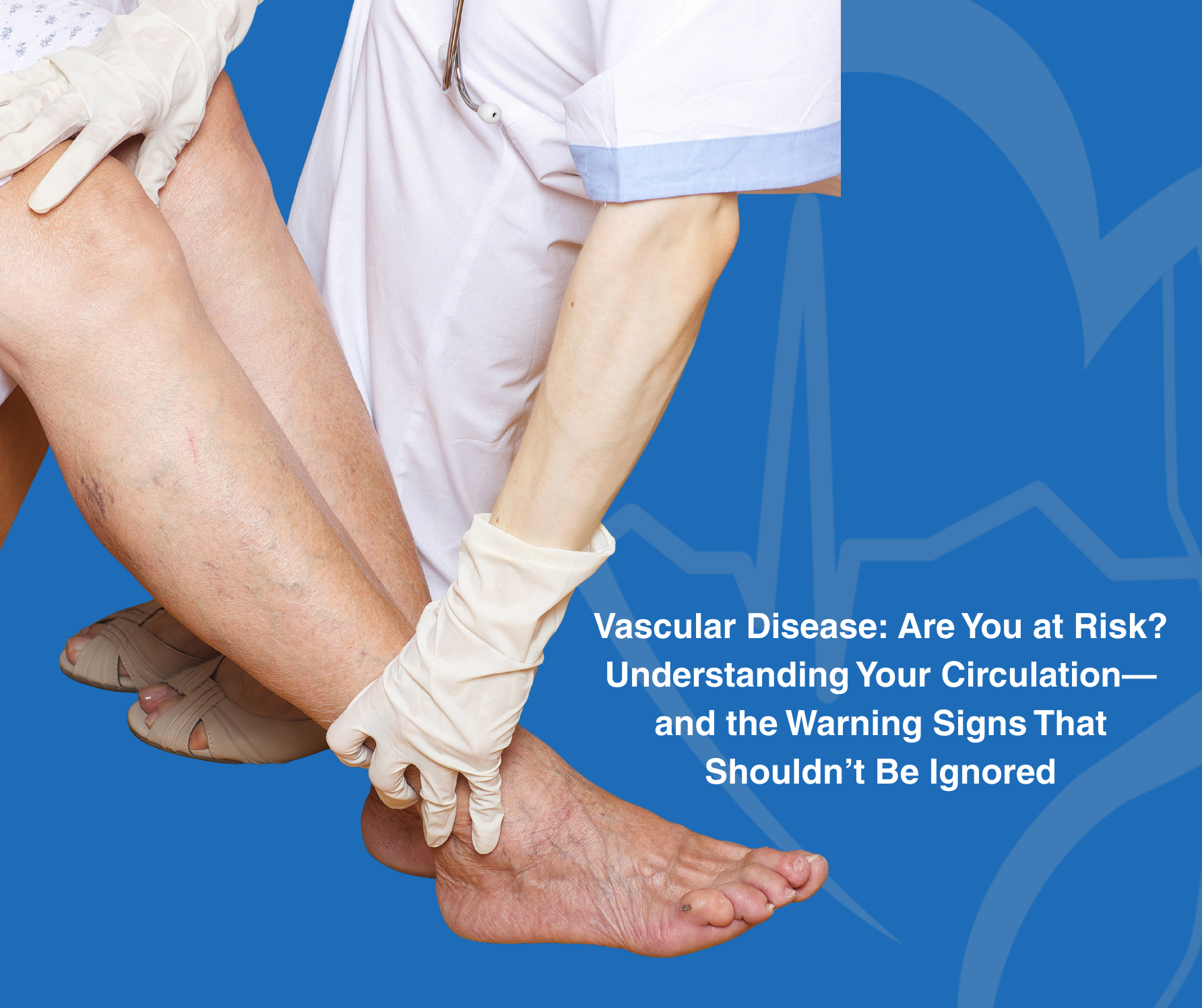 Vascular Disease: Are You at Risk