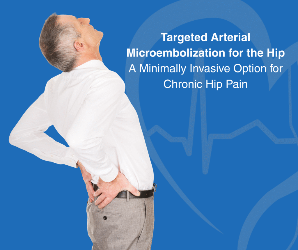 Targeted Arterial Microembolization for the Hip A Minimally Invasive Option for Chronic Hip Pain