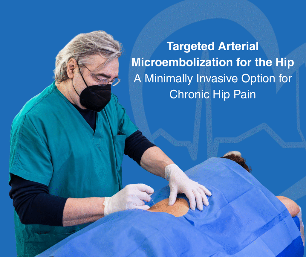 Targeted Arterial Microembolization for the Hip A Minimally Invasive Option for Chronic Hip Pain