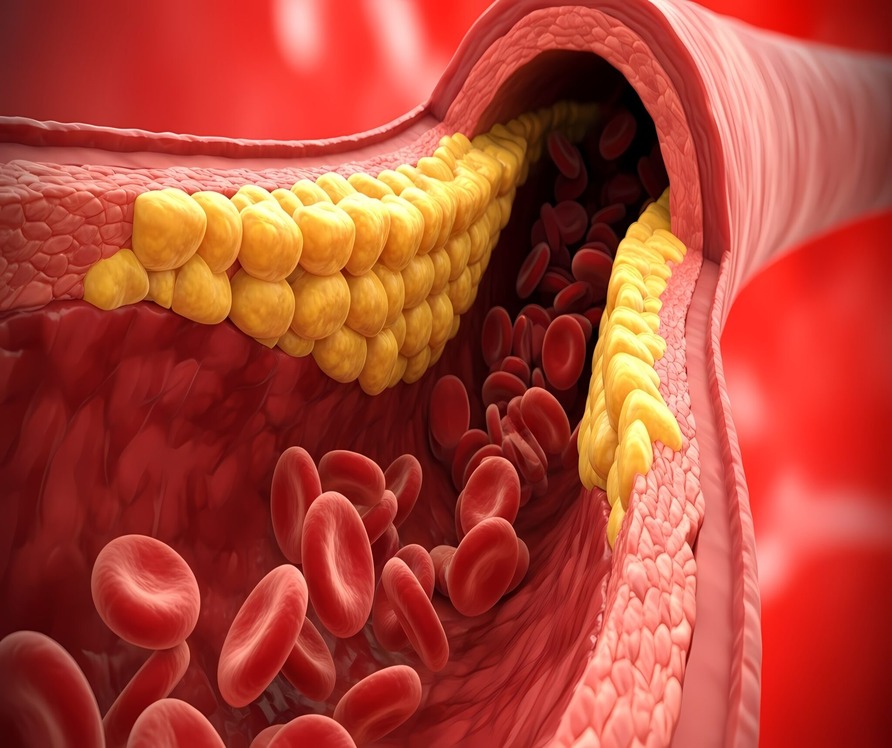 PAD 101: Start the New Year With a Circulation Screening