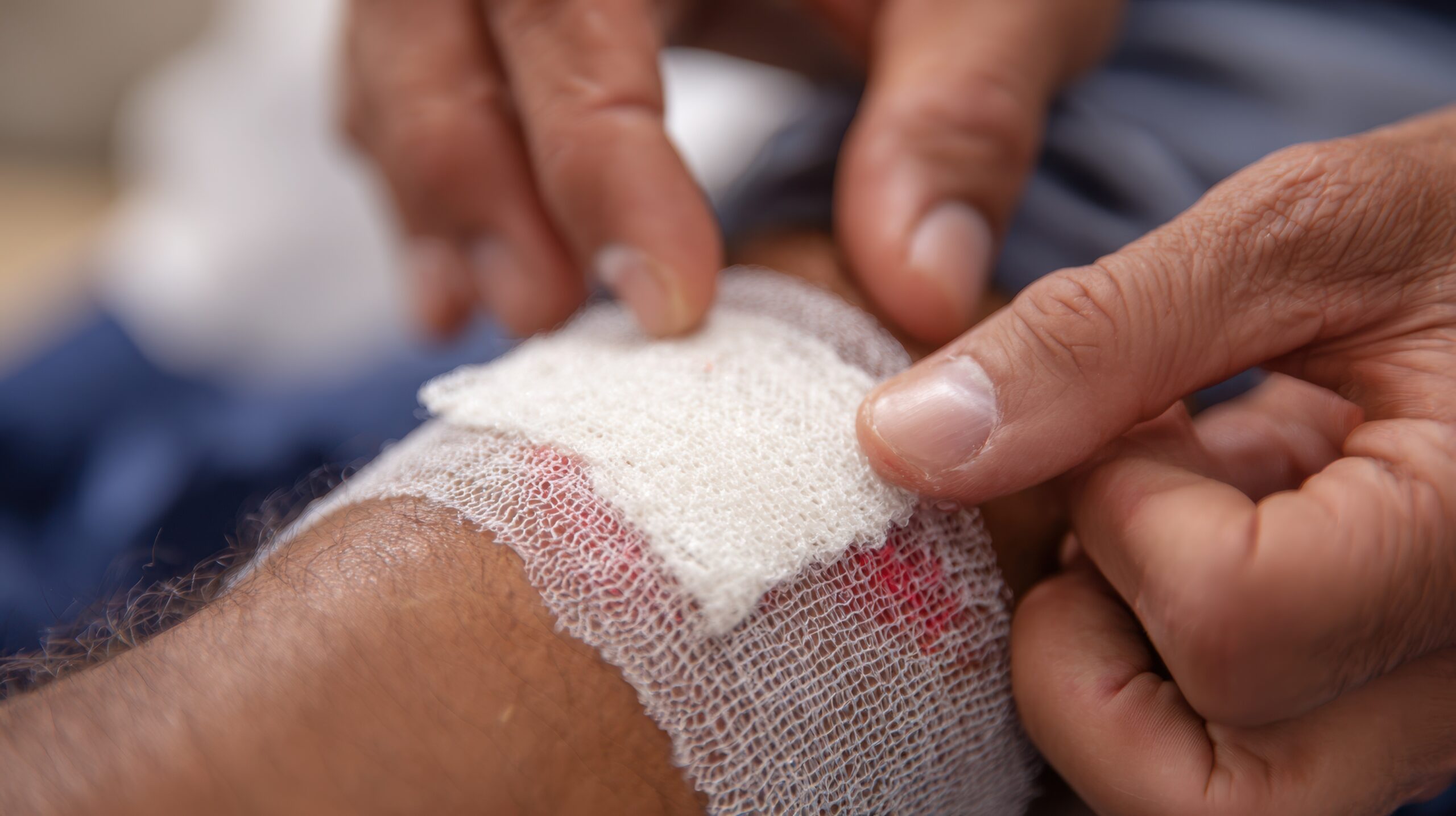When Wounds Don’t Heal: The Vascular Connection Patients Should Know