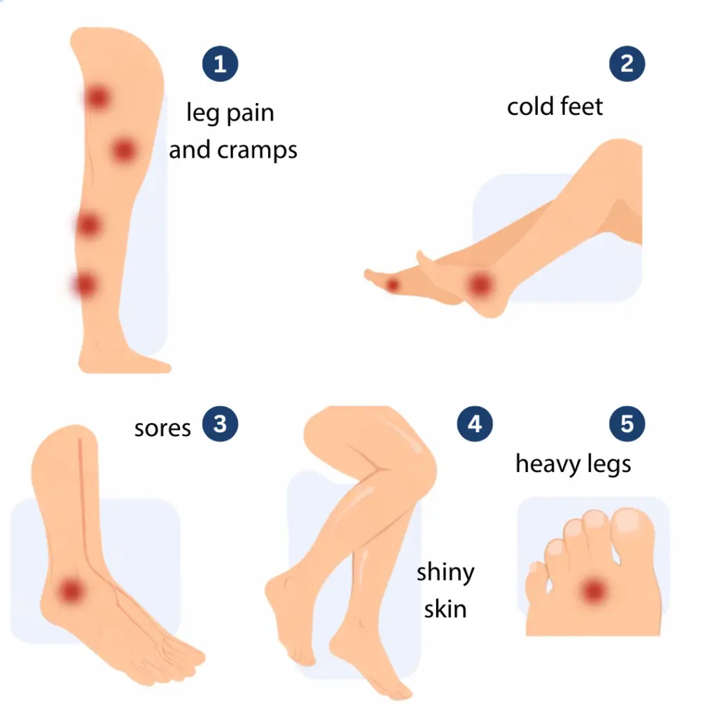 5 early warning signs of peripheral artery disease