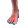 COLD FEET OR TOES
