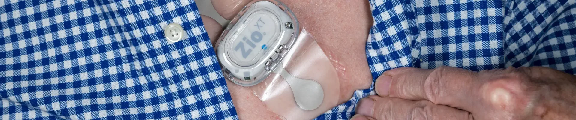 Morgantown, WV - 25 February 2023: Zio XT adhesive heart ECG monitor on male chest