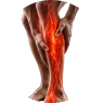 LEG HEAVINESS LEG HEAVINESS
