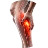PAIN WHILE WALKING