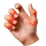 SWELLING